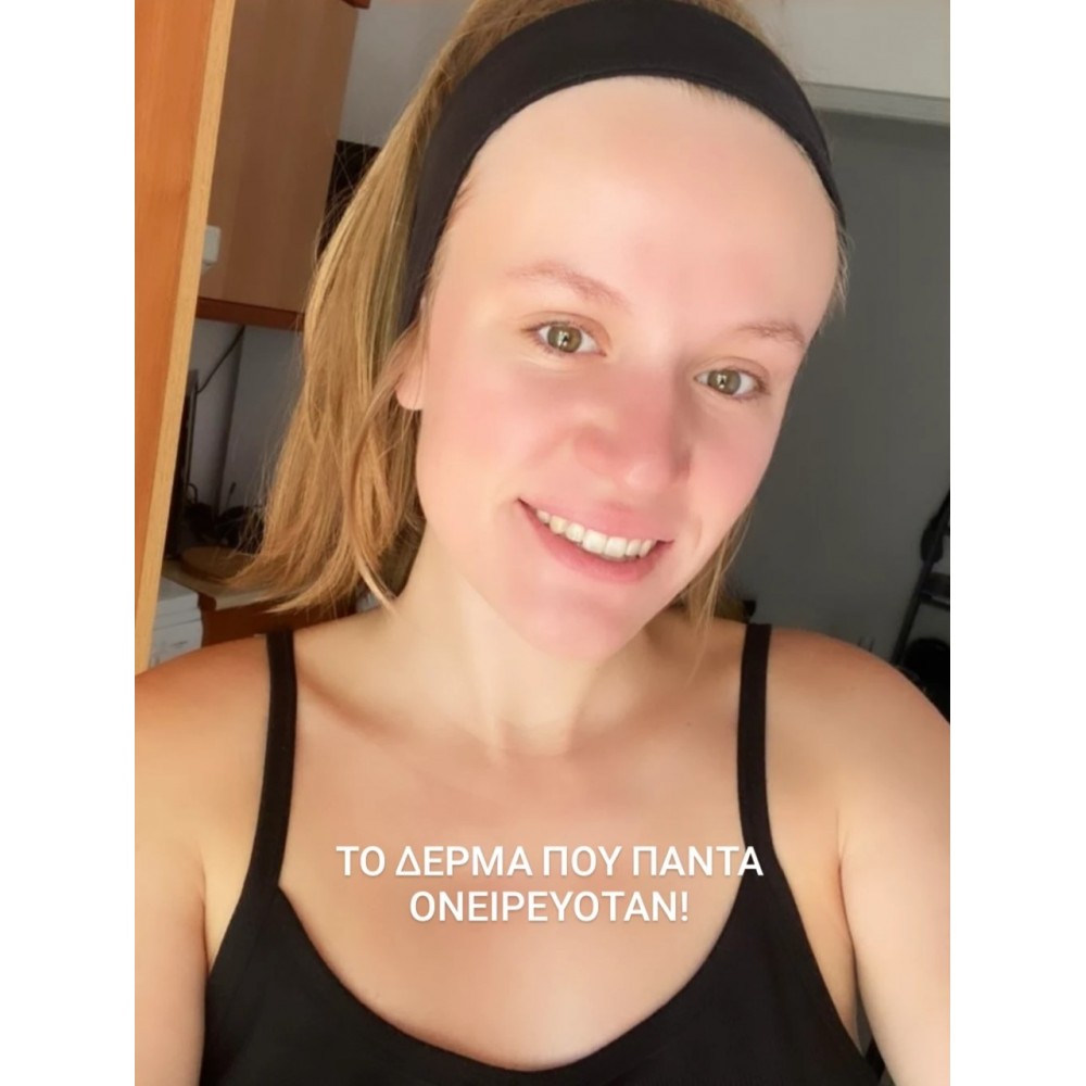 Bee Factor Κεραλοιφή Για Ακμή & Σπυράκια 40ml