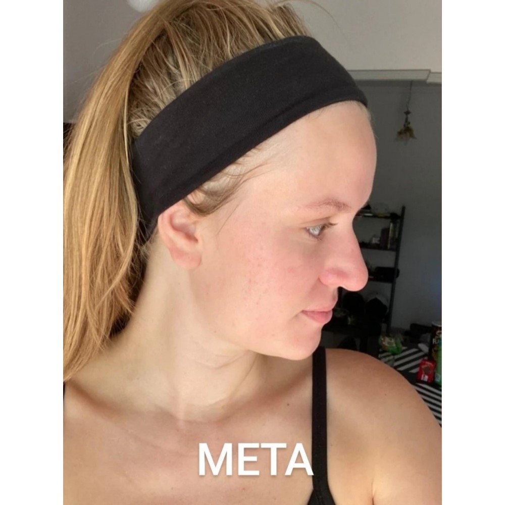 Bee Factor Κεραλοιφή Για Ακμή & Σπυράκια 40ml