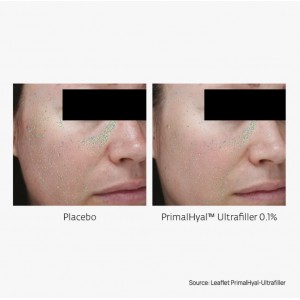 Mastic Origins Wrinkle Filler Serum 30ml