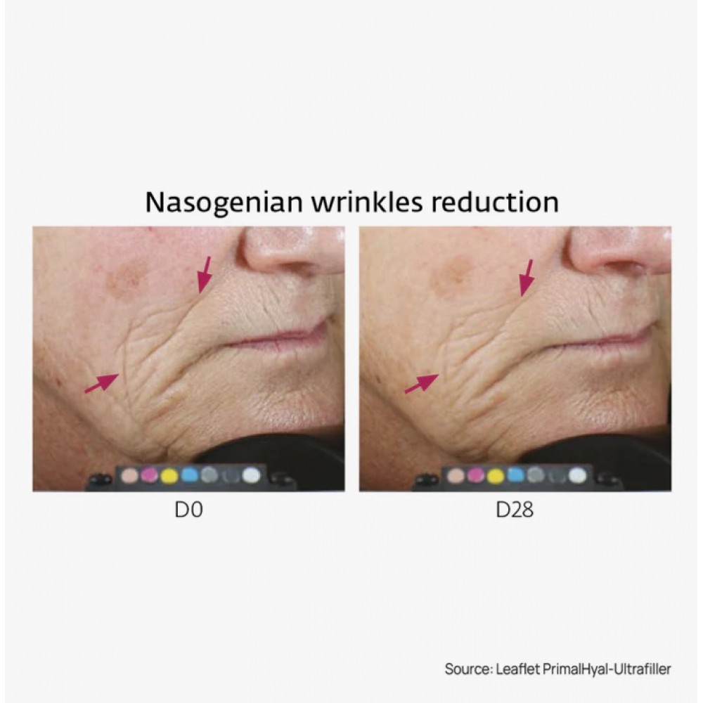 Mastic Origins Wrinkle Filler Serum 30ml